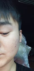 点击看大图 -苗方清颜·祛痘皮肤管理