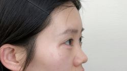 -Yestar艺星医疗美容医院