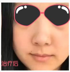 体验后-苏州卫康美容医院