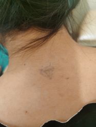 -海涛医疗美容·面部抗衰·注射美鼻