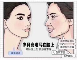 -倩极·精研痘敏肌管理