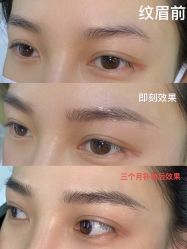 点击看大图 -OnFaer.纹眉半永久无创洗眉