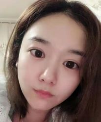 点击看大图 -天津健丽·去眼袋医疗美容机构