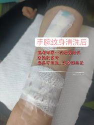 -净肤洗纹身