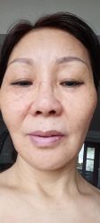 -坤如玛丽·医疗美容中心