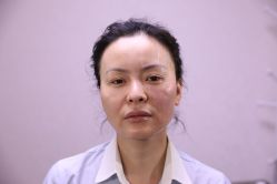 -北京叶子整形美容医院