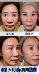 -安吉拉青春化管理中心