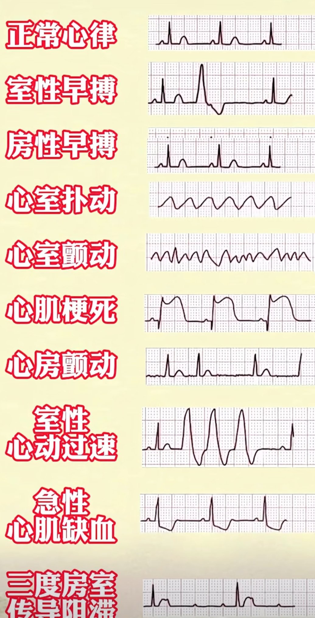 心跳正常范围图片