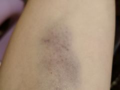 -北京市海淀医院-体检中心