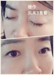睫毛嫁接-光SPA科技美肤