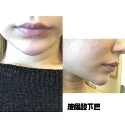 体验前-西安壹加壹医疗美容·西北抗衰旗舰店