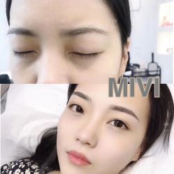 -MIVI半永久纹眉纹绣