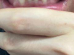 -微笑牙科口腔(三亚迎宾院区)