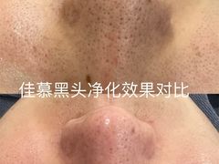 -中粮·祥云小镇