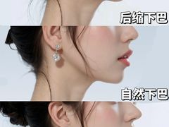 -上海仁爱医院