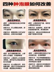 -洁铭新加坡医美