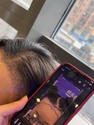 -碧莲盛·不剃发植发