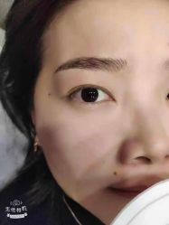 -郡艺医疗美容·微整·眼鼻吸脂