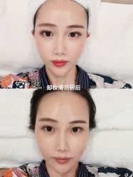 -SEAS小顏·日本小颜整骨美容サロン
