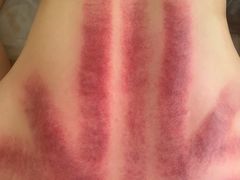 -左悦·艾灸调理·推拿按摩·精油SPA(卓悦汇店)