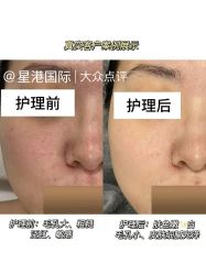 -星港国际·Skin皮肤专研·皮肤管理