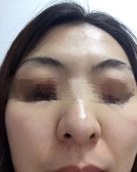 点击看大图 -美肤盾祛痘·问题肌头疗管理中心