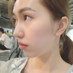 -南昌艾莱芙美容医院