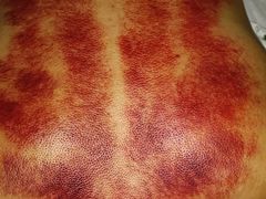 -番茄按摩·影院足道·柔足SPA