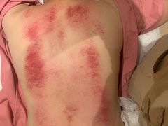 -阮氏中医推拿·颈肩腰腿(世纪公园店)