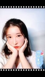 点击看大图 体验后-大麦微针植发全国连锁