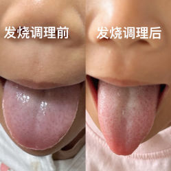 -童佑康专业小儿推拿