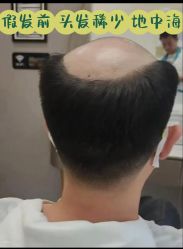 -唐风采假发补发定制