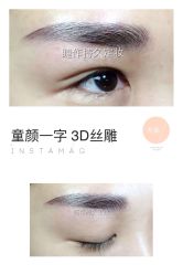 点击看大图 纹绣-光SPA科技美肤