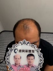 -唐风采假发补发定制