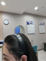 -碧莲盛不剃发植发