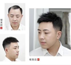 -唐风采假发补发定制
