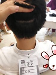 -大麦微针植发丨全国连锁