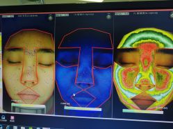 皮肤检测-光SPA科技美肤