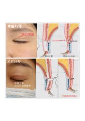 -丰联丽格医疗美容·联合丽格眼整形中心