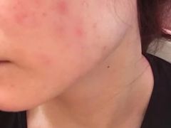 -中国医学科学院皮肤病医院