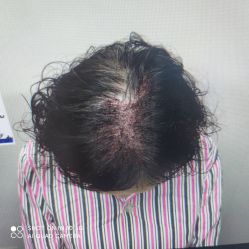 -雍禾植发全国连锁