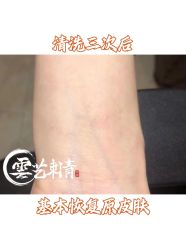 -雲艺刺青·洗纹身