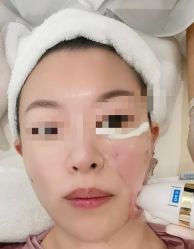 体验前-金圣医疗美容