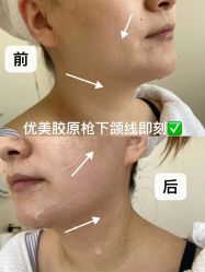 -美愈美肤MEIYU SKIN