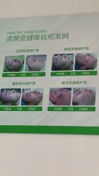 点击看大图 -清颜堂丨分子祛痘·功效美肤