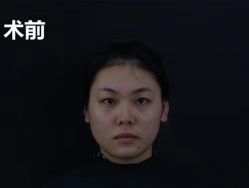 -AIST爱思特医疗美容医院