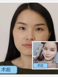 -广东韩妃整形外科医院