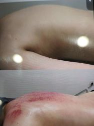 -苑苑vbeauty科技美容SPA