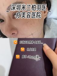 -深圳米兰柏羽医疗美容医院