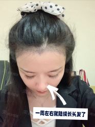 -雍禾植发全国连锁